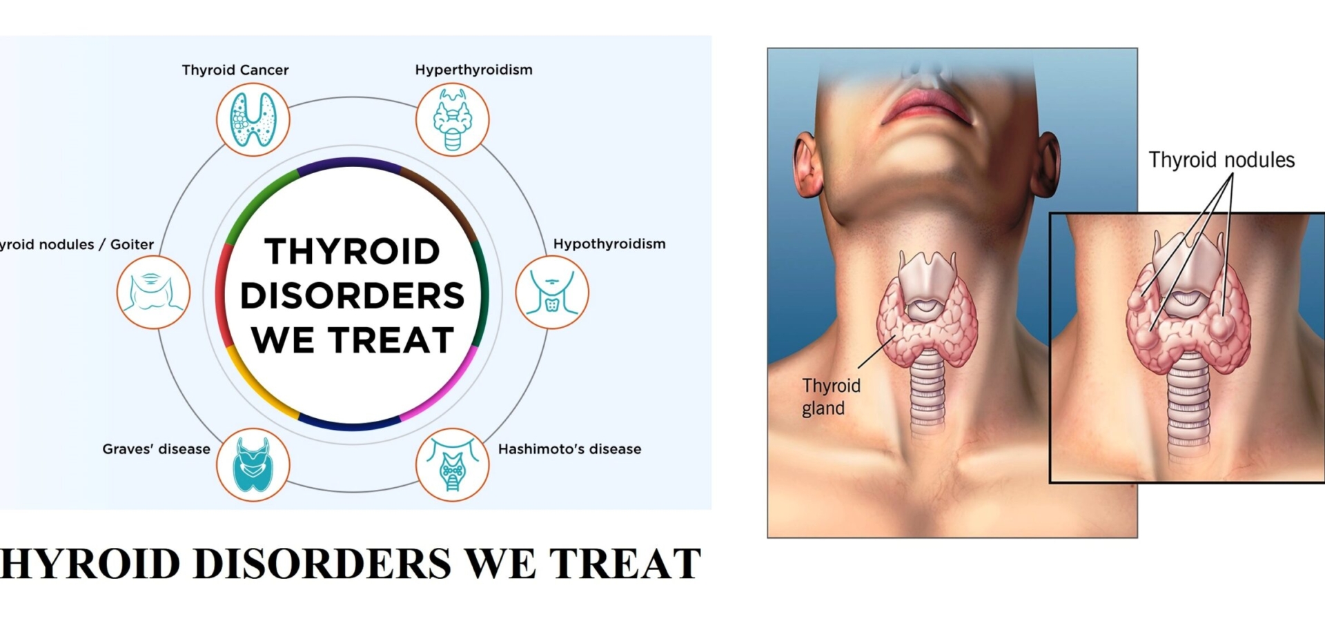 Best Diabetes doctor in Thane Diabetes Specialist in Thane